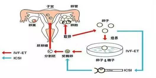 北京怀双胞胎